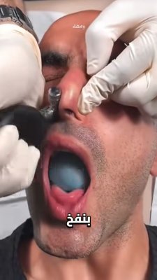 👃 أفضل طرق لحل مشاكل الأنف بسهولة وفعالية

#صحة #نصائح_طبية #عناية_بالصحة #انسداد_الأنف #التهاب_الجيوب #حساسية_الأنف #نزيف_الأنف #معلومات_صحية #اكسبلور #shorts